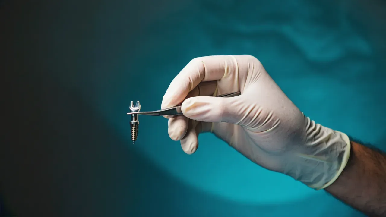 Mano guantata del chirurgo che tiene con precisione un impianto dentale: è la mano, non l'arnese, a fare la differenza