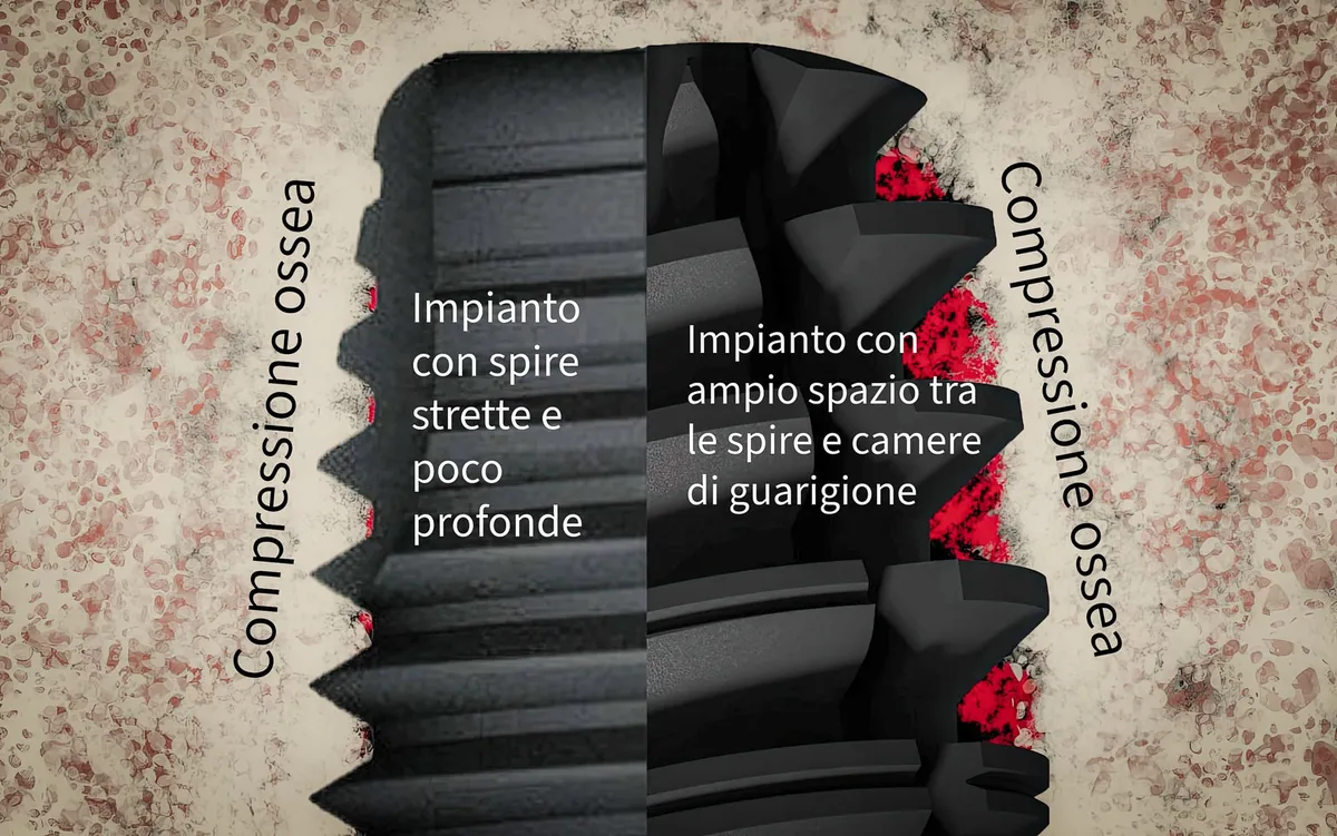 50ncm-e-piu-benefici-e-rischi-del-torque-alto