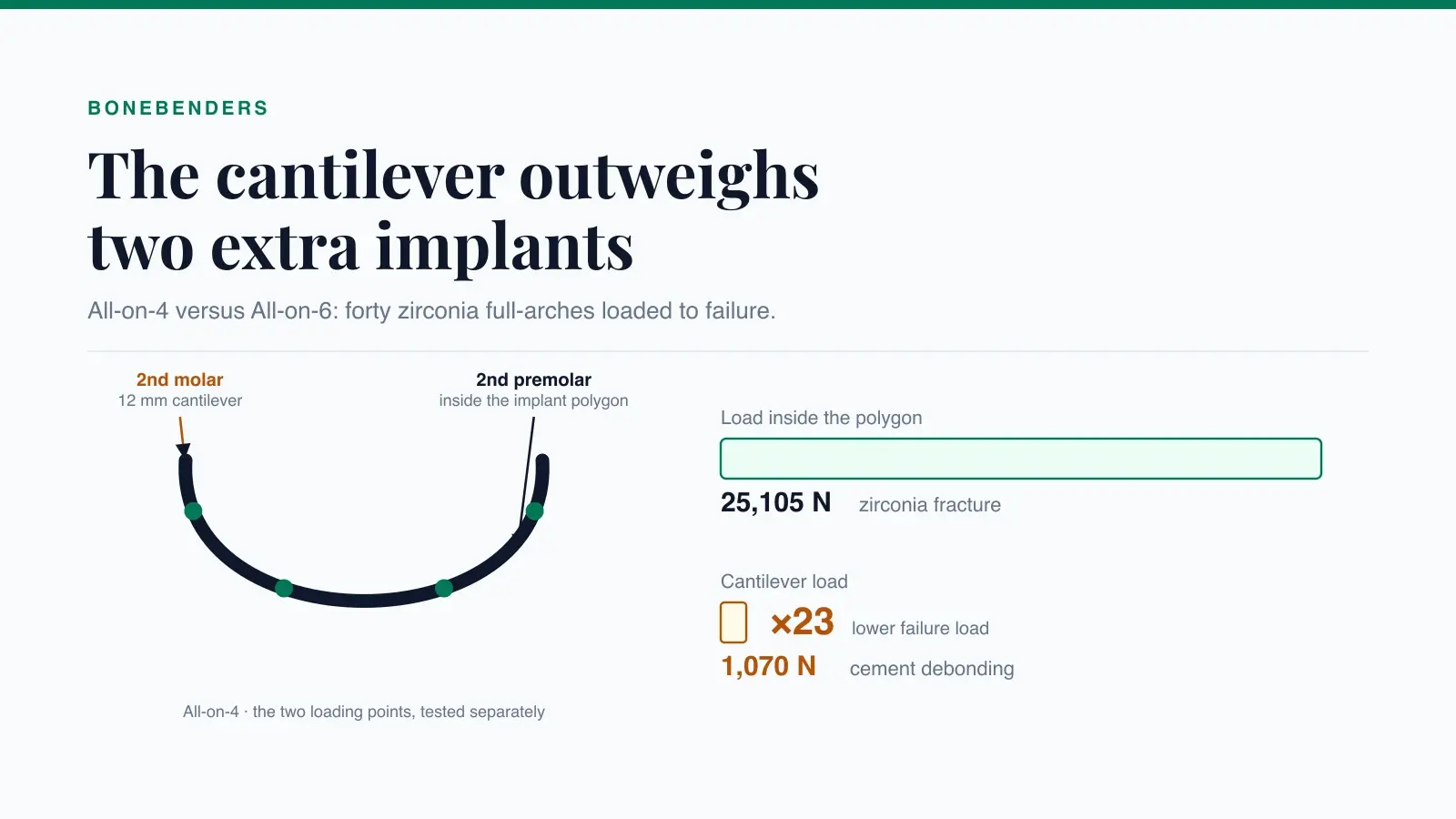 Full-arch on four implants with the two loading points, and failure-load comparison: 25,105 N inside the implant polygon versus 1,070 N in cantilever