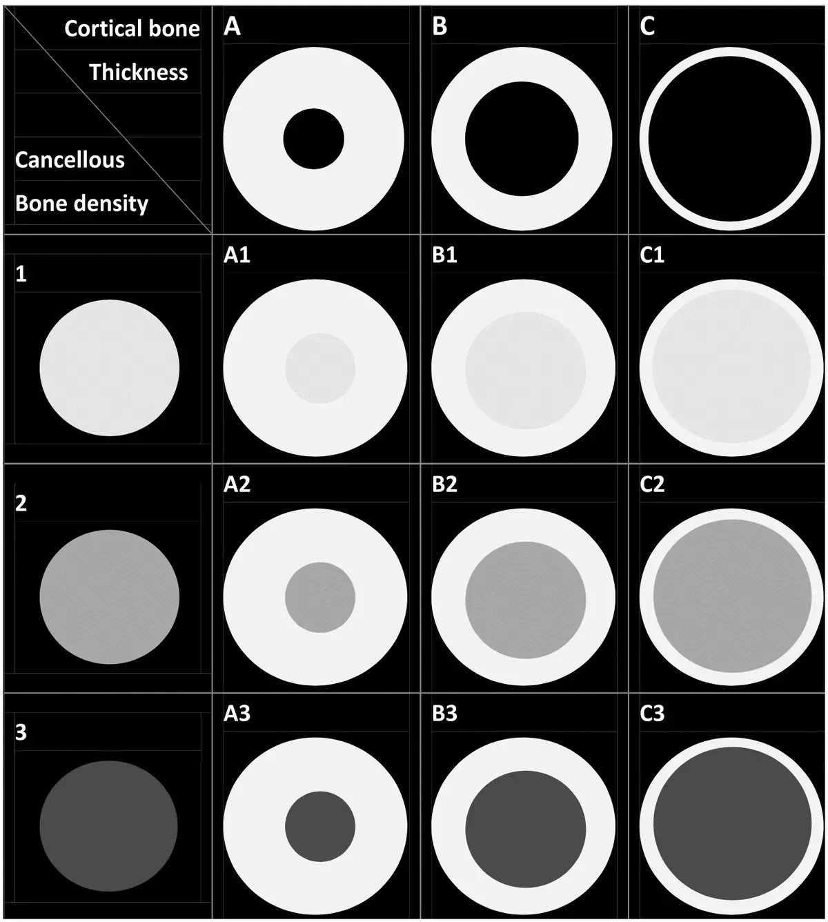 Wang A1-C3 Alveolar Bone Classification: Beyond Misch D1-D4