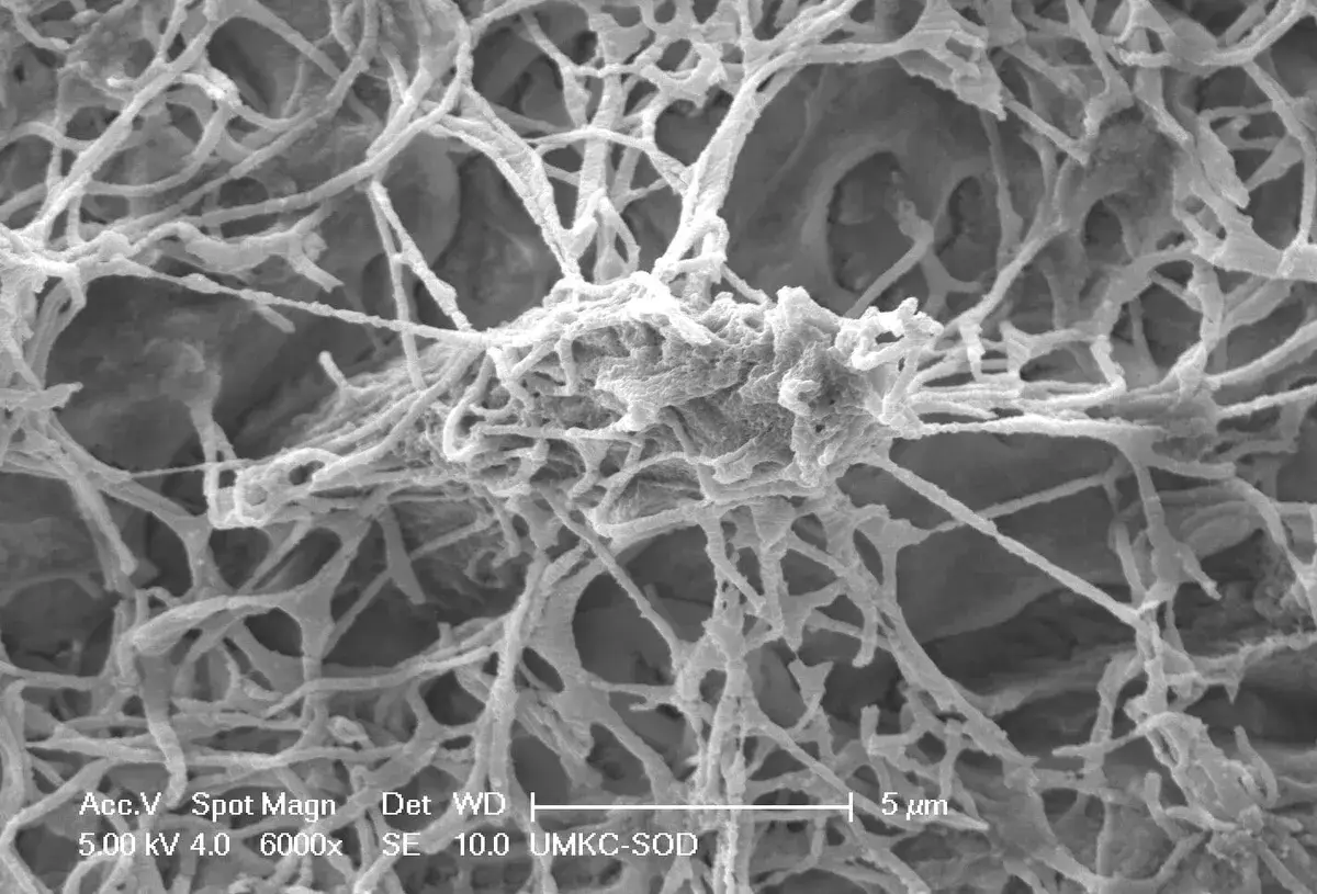 The Bone's Neural Network: The Osteocyte Connectome