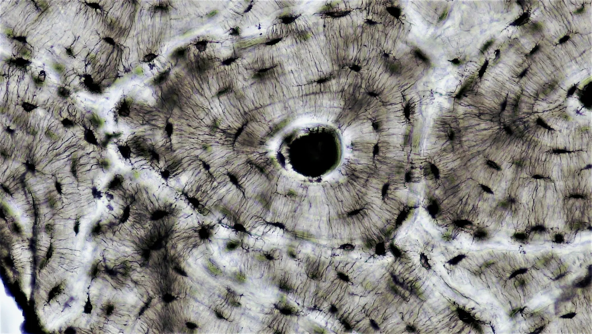 Sezione istologica dell'osso corticale — canale di Havers, lamelle concentriche e osteociti