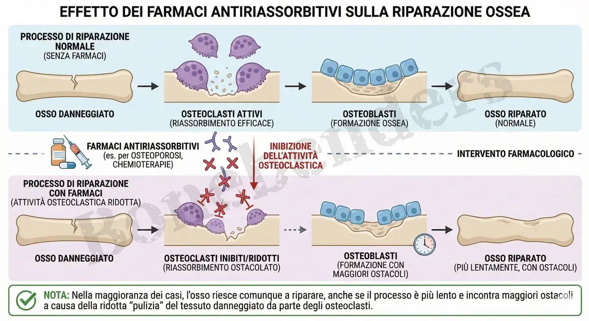 Bifosfonati, Prolia e Impianti Dentali: Consensus 2025