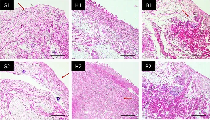 Sezioni istologiche colorate con ematossilina-eosina che confrontano la gengiva cheratinizzata, la mucosa palatina e la mucosa alveolare. Si osservano le differenze nello spessore epiteliale, nell'altezza delle papille connettivali e nella densità della lamina propria. Da Choi JJE et al., Clin Exp Dent Res, 2020. CC BY 4.0.