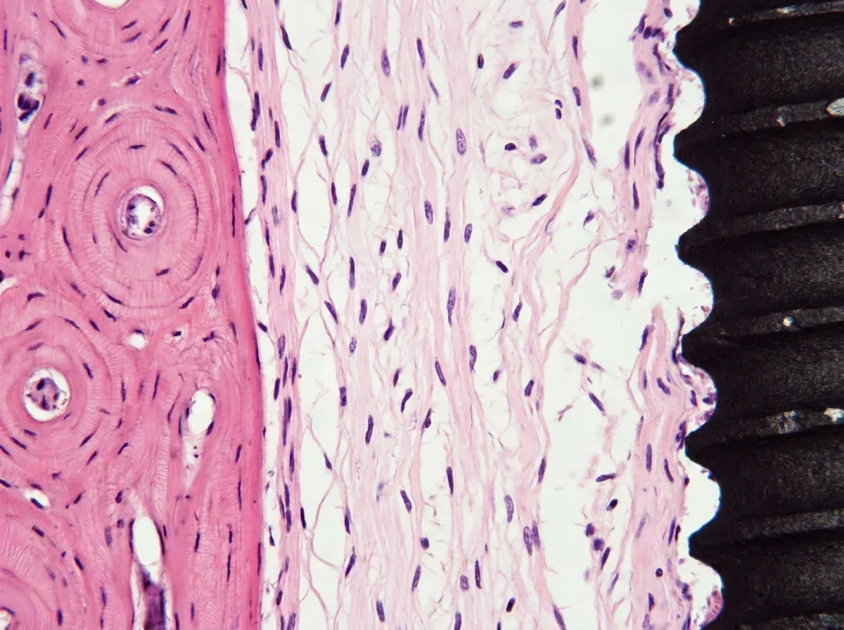Sezione istologica di fibrointegrazione: membrana fibrosa interposta tra osso lamellare (sinistra) e superficie dell'impianto in titanio (destra)