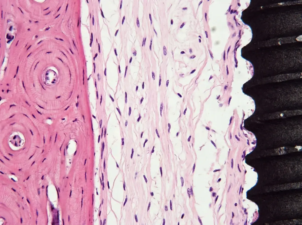 Sezione istologica di fibrointegrazione: membrana fibrosa interposta tra osso lamellare (sinistra) e superficie dell'impianto in titanio (destra)