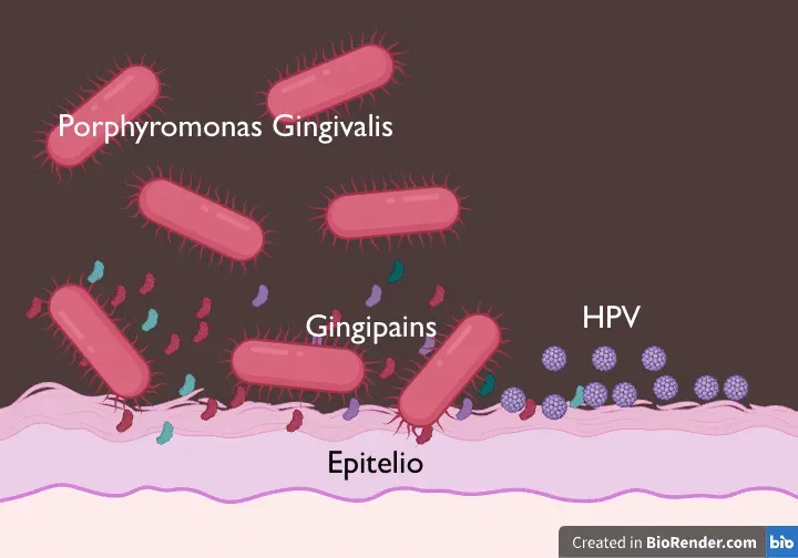 Graphic representation of Porphyromonas gingivalis bacteria, gingipains and HPV interacting with the epithelium