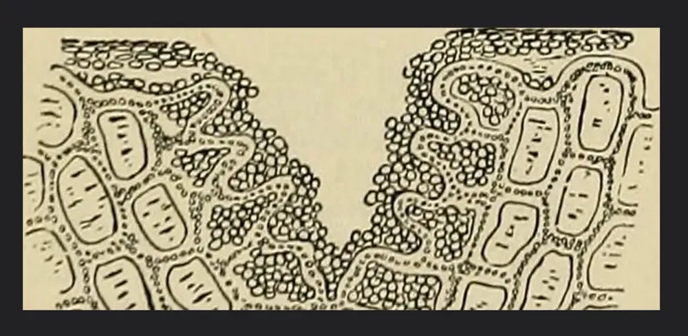 Illustrazione scientifica che rappresenta una sezione del tessuto cheratinizzato, evidenziando la struttura cellulare e le caratteristiche morfologiche, utile per la discussione sulla rigenerazione osteo-mucosa e l