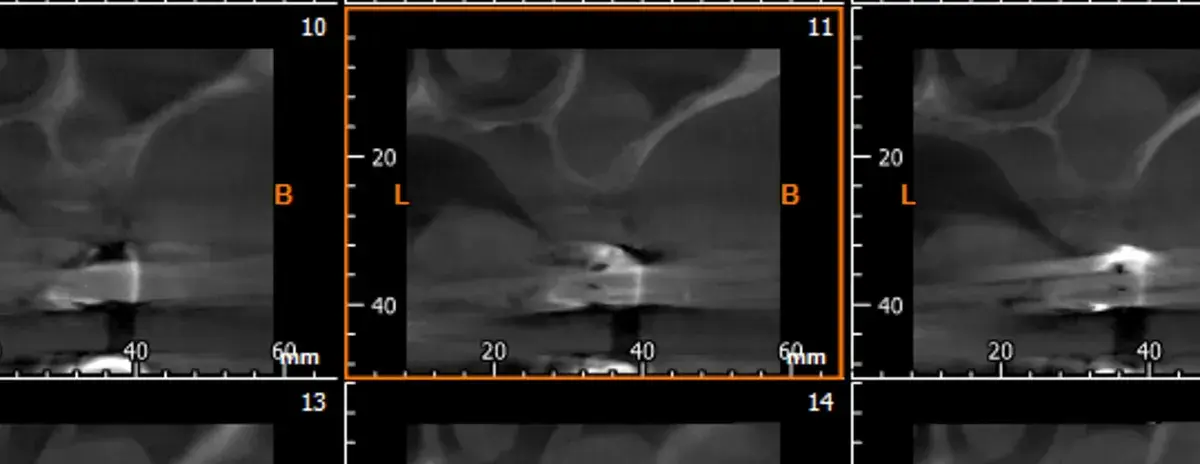 La storia di Francesco