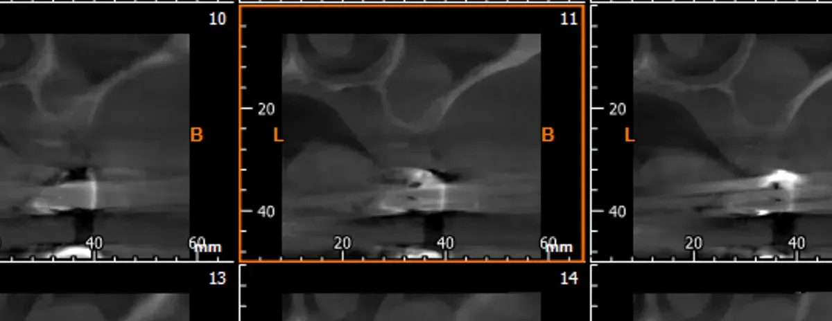 La storia di Francesco