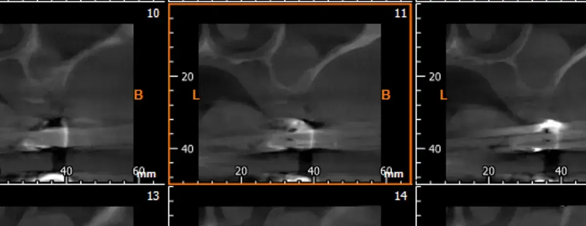 La storia di Francesco