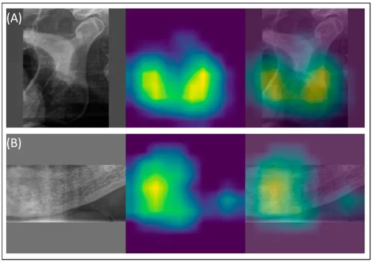 Visualizzazione GradCAM su panoramica dentale: le zone giallo-verdi indicano dove l'AI identifica i segni di osteoporosi nella corticale mandibolare.