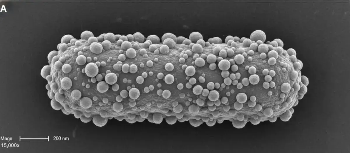 Parodontite e Alzheimer: Un Batterio Infetta il Cervello