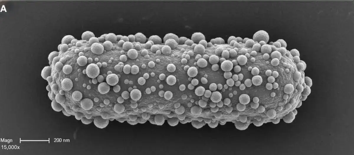 Periodontitis and Alzheimer's: A Bacterium Infects the Brain