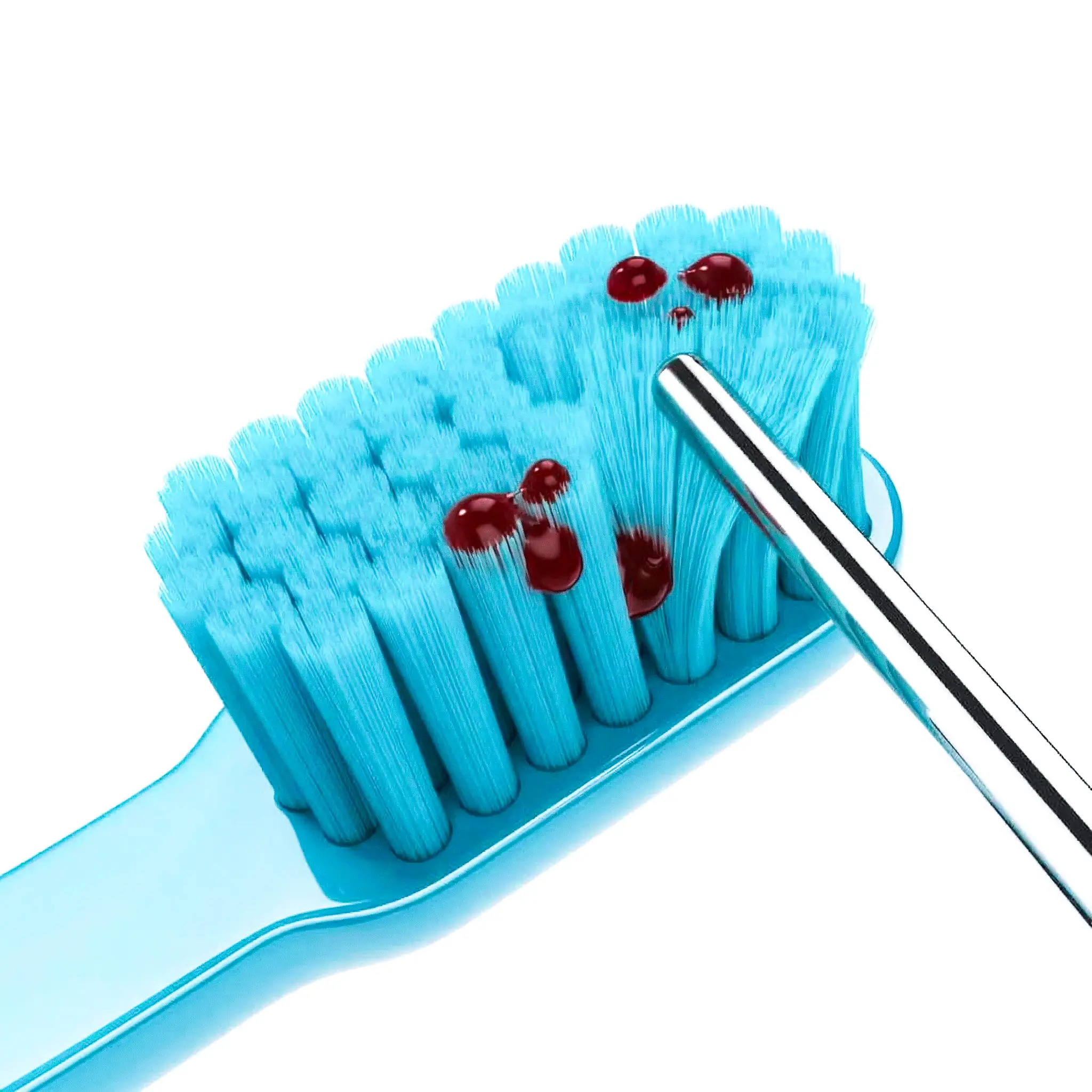 Pyorrhea — periodontal probing at Studio Denti Più in Frosinone