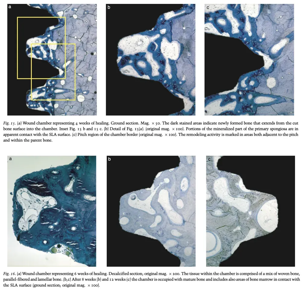 Histological image showing the bone healing process in an implant specimen at 4 and 6 weeks, highlighting areas of newly formed bone near the implant surface
