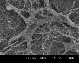 Proteine che Innescano l’Osteointegrazione: 3 Fasi