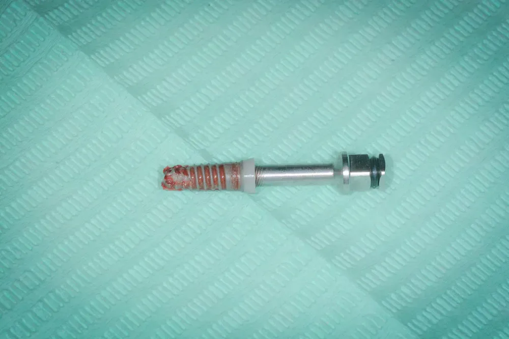 Removal of an incongruous implant