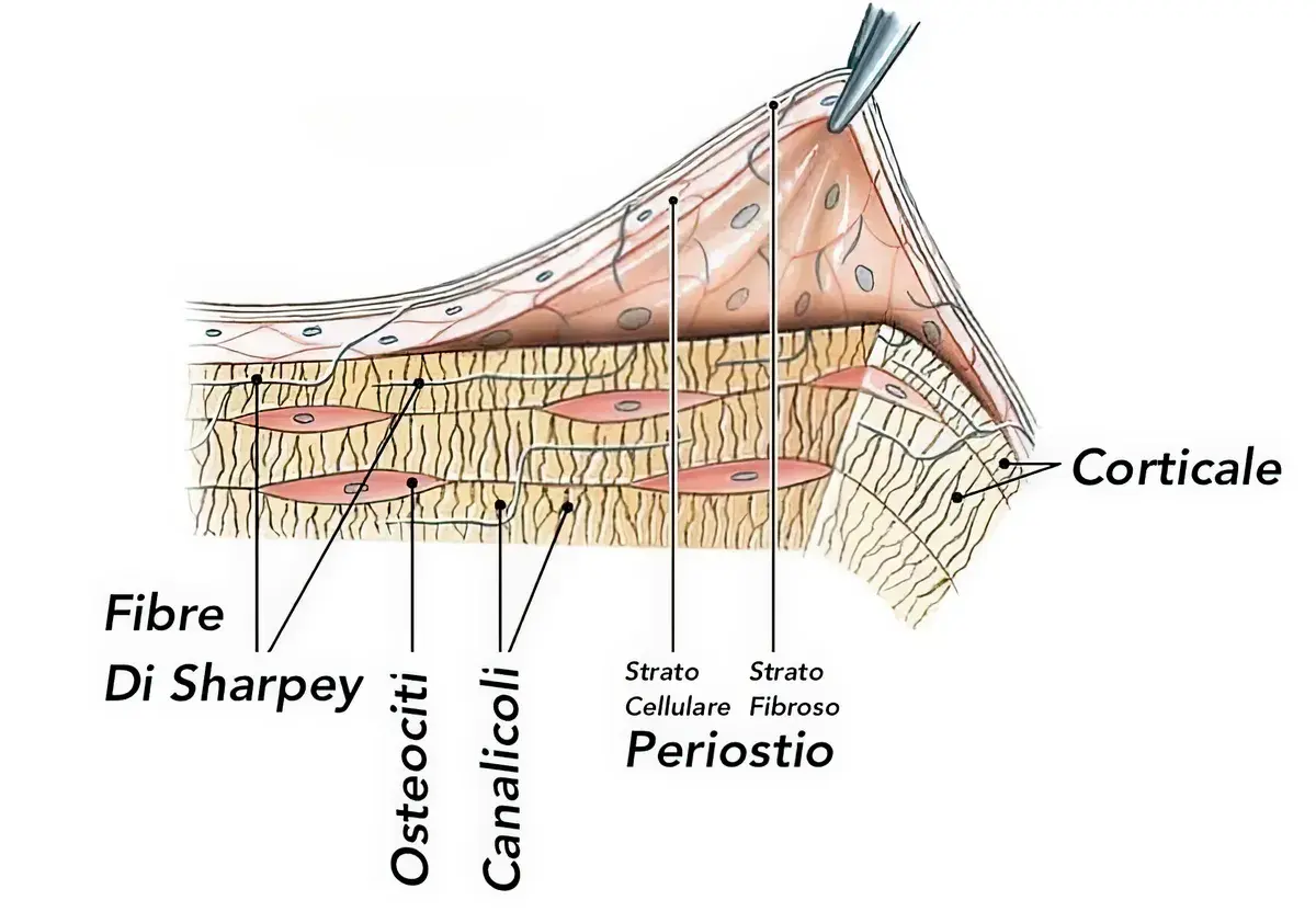 Split crest: does the partial-thickness flap really matter?