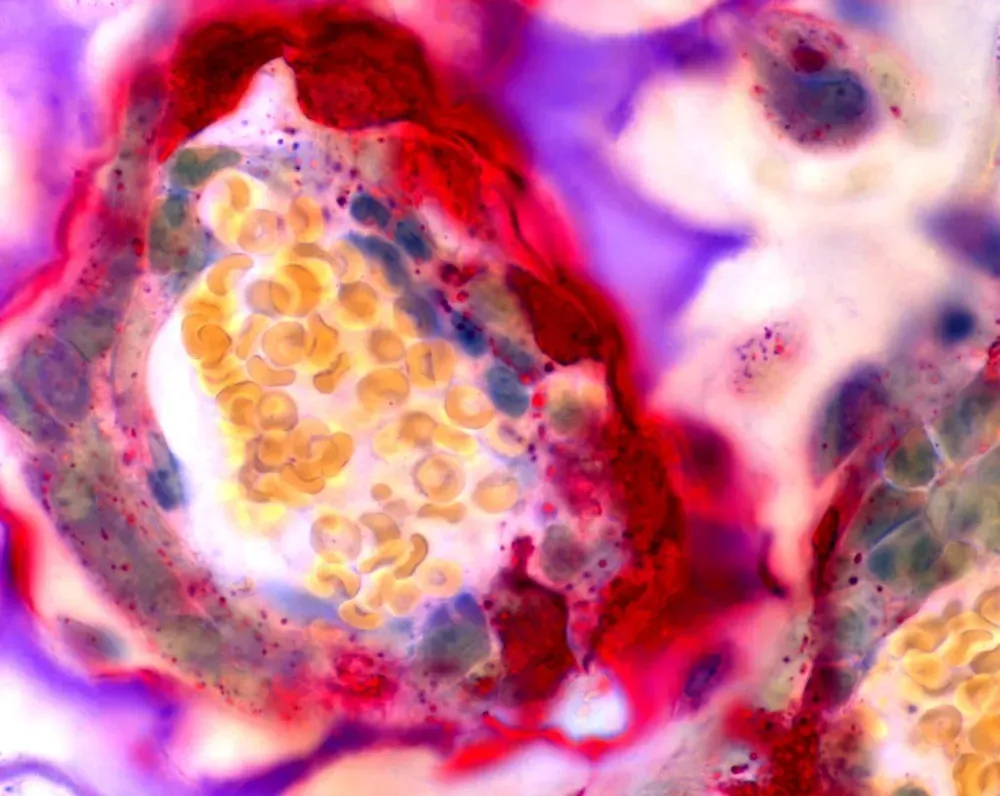 Immagine al microscopio di osteoclasti dalla collezione NIAMS NIH