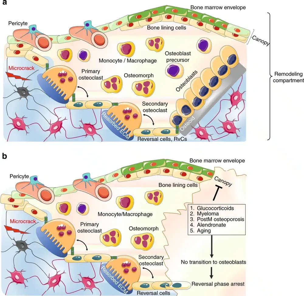 Bone Remodeling Compartment (BRC): struttura del compartimento di rimodellamento osseo con canopy, osteoclasti e osteoblasti