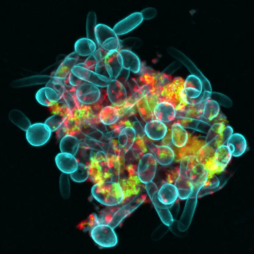 Confocal fluorescence microscopy of an oral microbial cluster in saliva: Candida albicans (cyan), Streptococcus mutans (green) and α-glucans (red). Image: NIH/Zhi Ren, public domain.