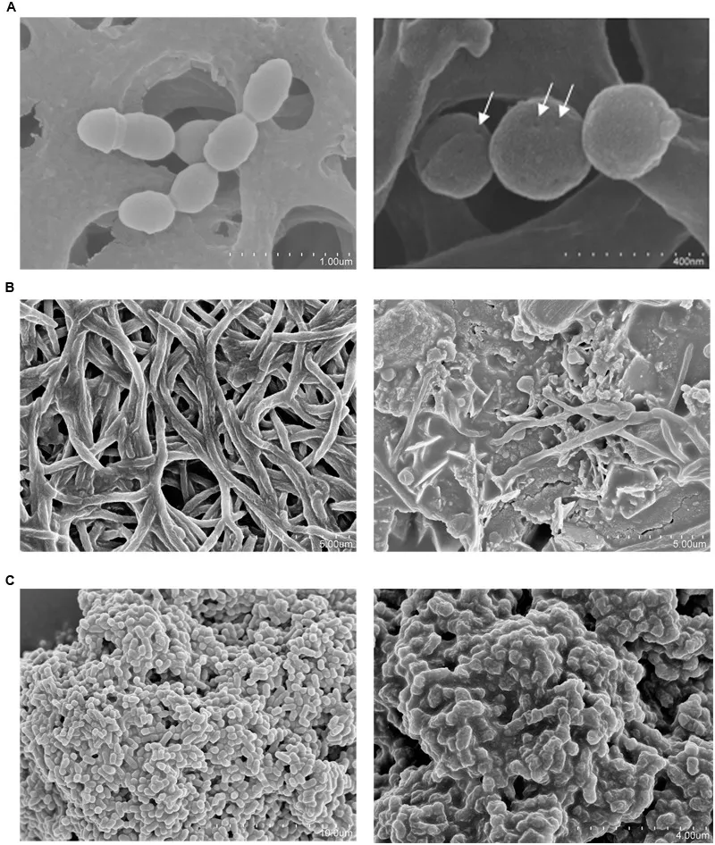 Scanning electron microscopy (SEM) of three oral pathogens before and after treatment with concentrated S. dentisani supernatant. (A) S. mutans with visible membrane pores. (B) F. nucleatum. (C) P. intermedia. Source: López-López et al. 2017, Front Microbiol, CC-BY 4.0.