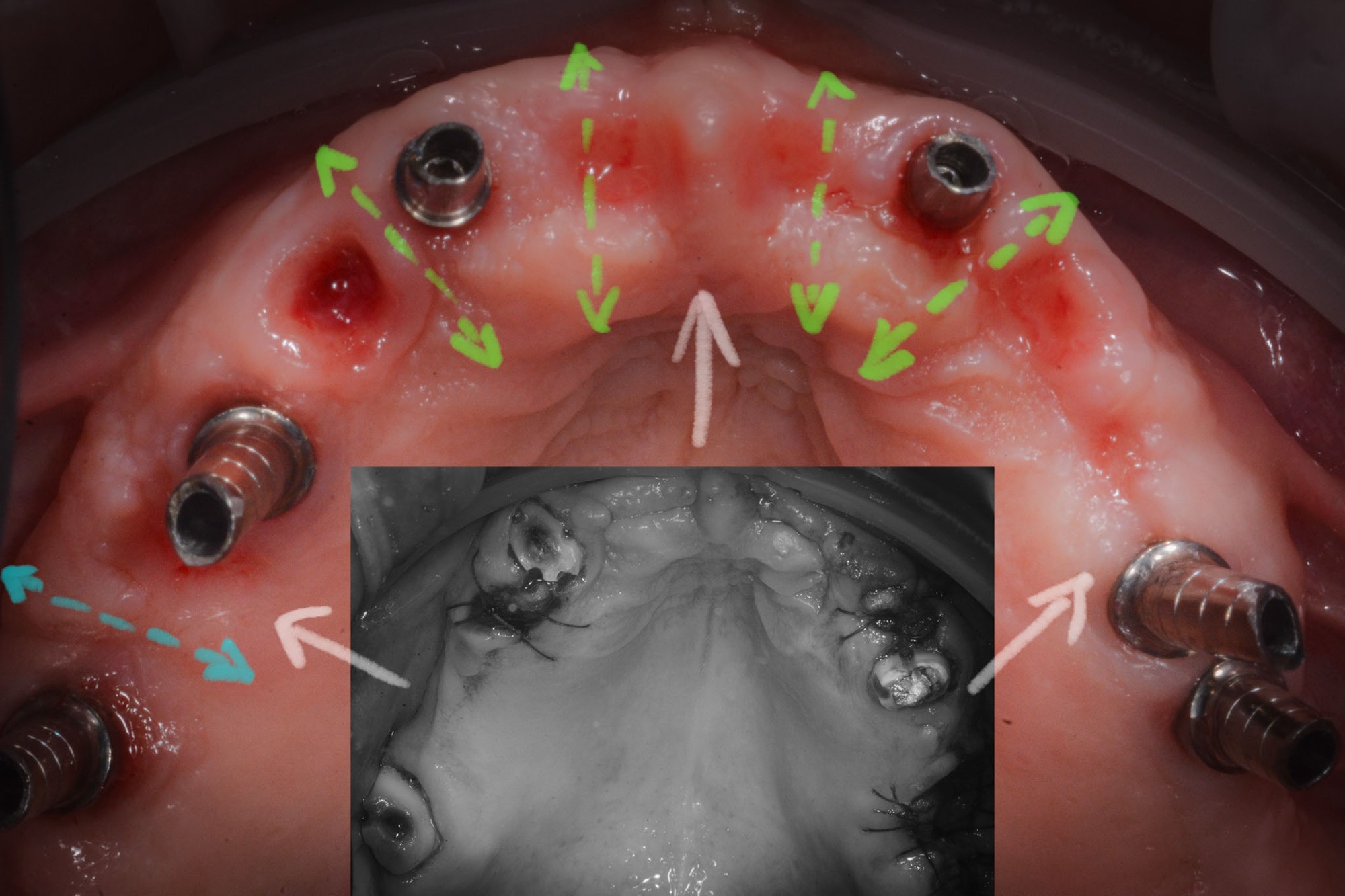 L’espansione è magica. Rigenera secondo natura.