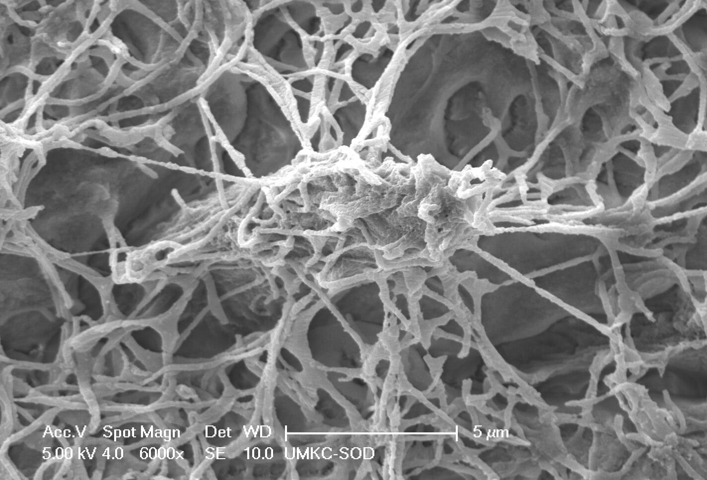 Murine_mandibular_osteocytetif - Bonebenders Murine_mandibular_osteocytetif SEM image of a murine mandibular osteocyte at 6000x magnification https://commons.wikimedia.org/wiki/File:Murine_mandibular_osteocyte.tif CC4.0