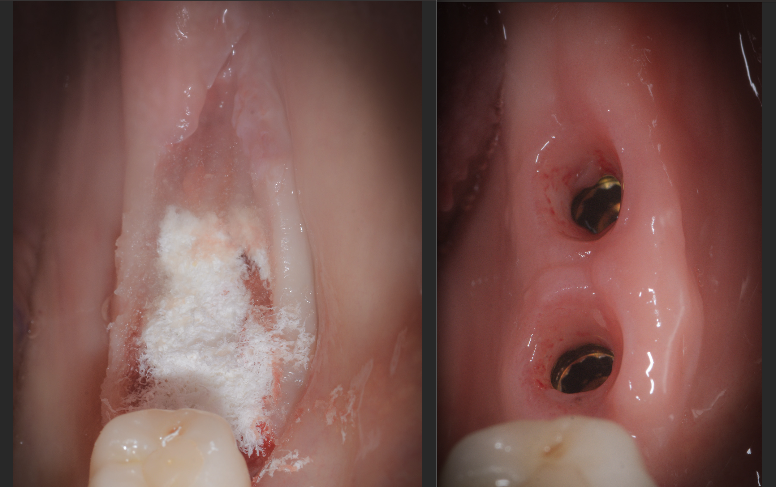 La “Rivoluzionaria” Scoperta dell’Acqua Calda