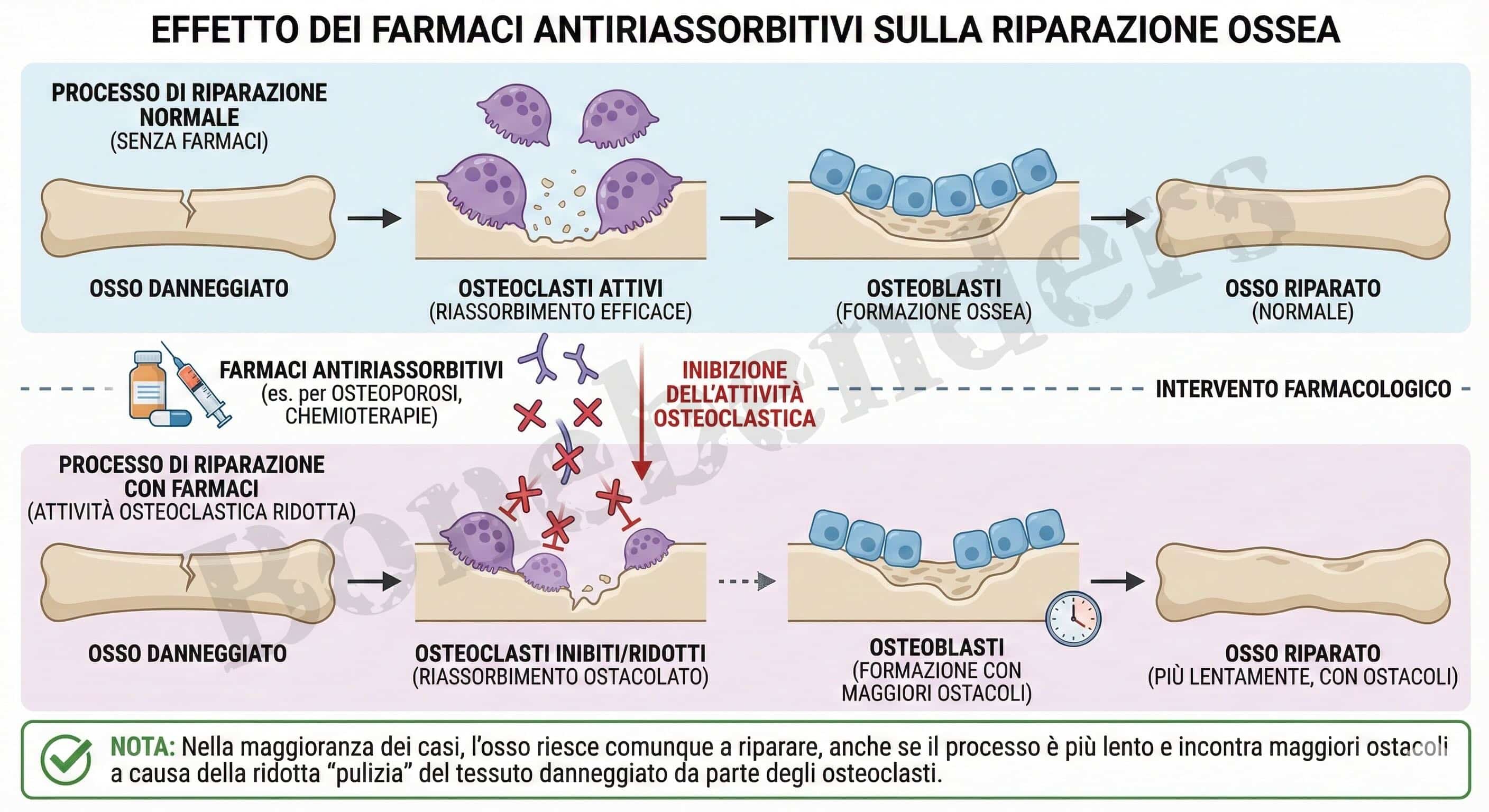 Senza titolo 19 effetti dei bifosfonati e denosumab sul tessuto osseo