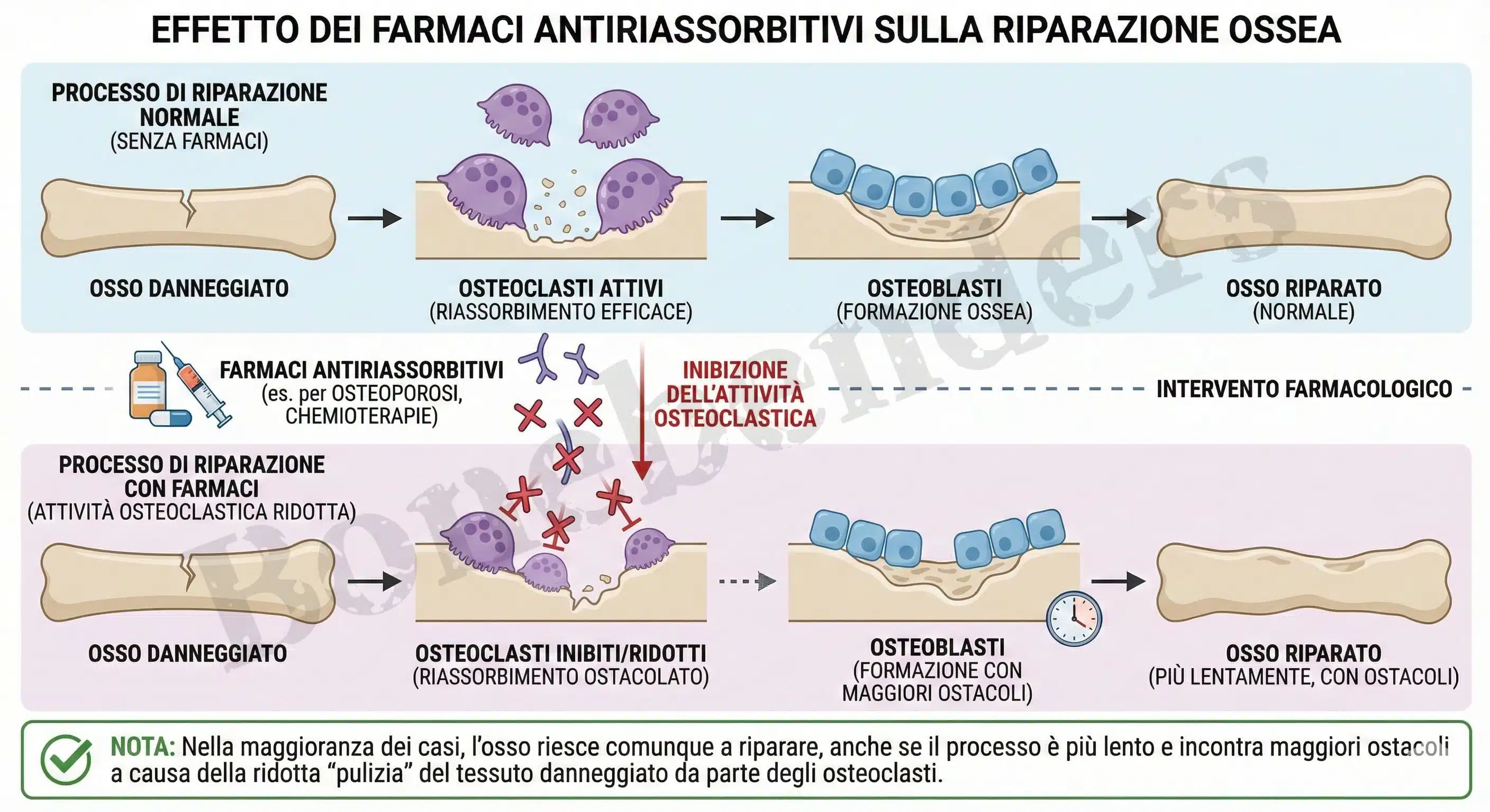 Farmaci contro l’osteoporosi? Novità nel consensus 2025.