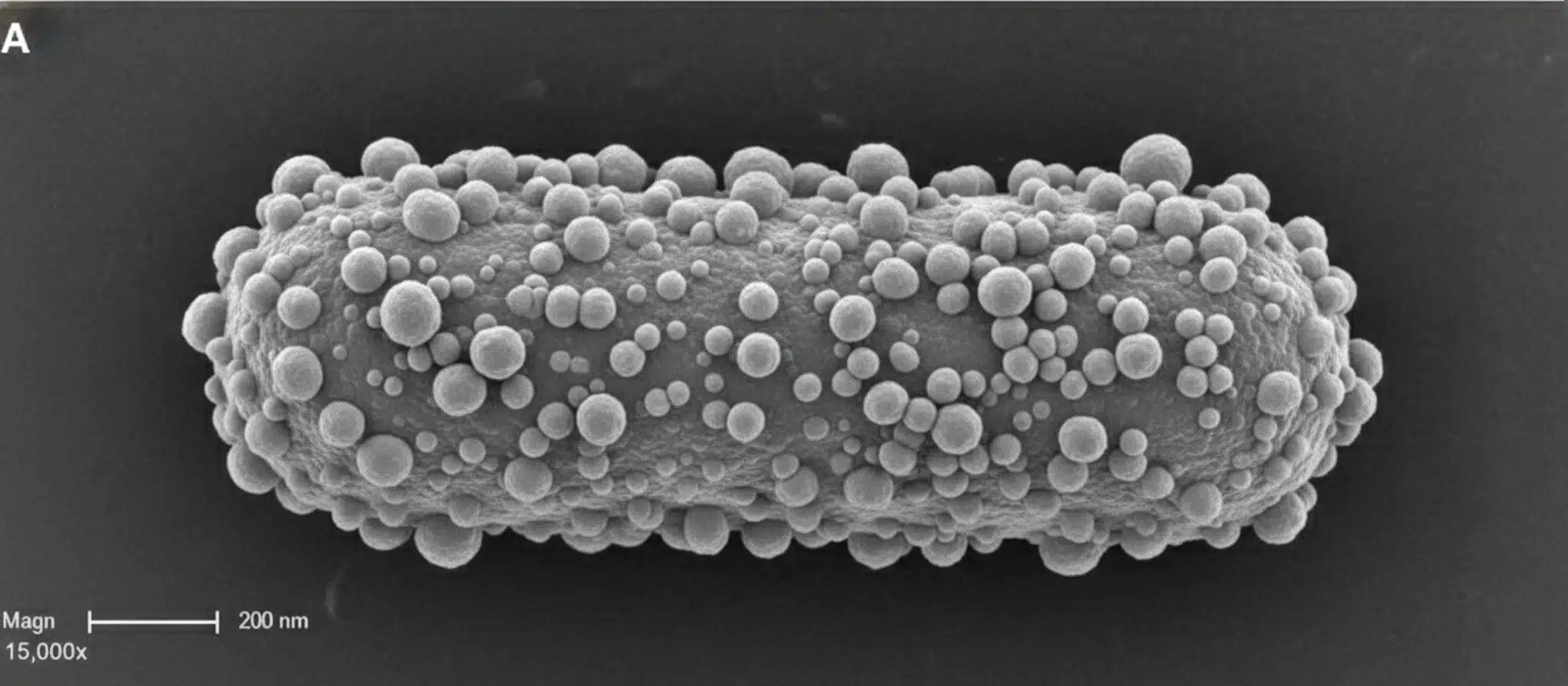 Bonebenders00001jh 1 di 1 - Bonebenders Bonebenders00001jh 1 di 1 Artistic depiction of a porphyromonas gingivalis SEM image